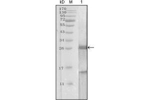 Western Blotting (WB) image for anti-Prostate Specific Antigen (PSA) (AA 26-251) antibody (ABIN2983296) (Prostate Specific Antigen antibody  (AA 26-251))