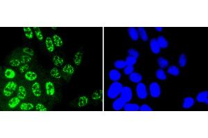 Immunofluorescence (IF) image for anti-SMAD, Mothers Against DPP Homolog 2 (SMAD2) (pThr183), (pThr221) antibody (ABIN3061343)