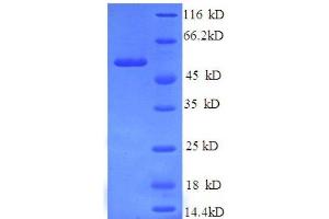 Replication Protein A2, 32kDa (RPA2) (AA 1-267), (partial) protein (GST tag) (RPA2 Protein (AA 1-267, partial) (GST tag))