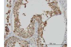 Immunoperoxidase of monoclonal antibody to HSPA1L on formalin-fixed paraffin-embedded human testis. (HSPA1L antibody  (AA 561-641))