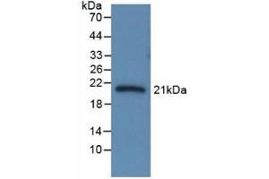 SERPINA6 抗体  (AA 173-344)