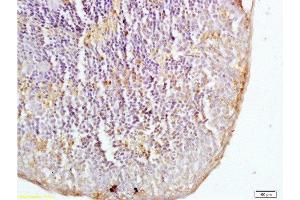 Formalin-fixed and mouse spleen tissue labeled with Anti-DECTIN-1/CLECSF12/beta Glucan Receptor Polyclonal Antibody, Unconjugated  at 1:200 followed by conjugation to the secondary antibody and DAB staining (CLEC7A antibody  (AA 41-140))