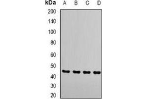 Western blot analysis of RRM2 expression in MCF7 (A), Hela (B), Jurakt (C), mouse thymus (D) whole cell lysates. (RRM2 antibody)