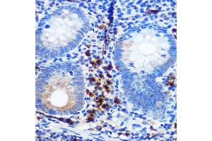 Immunohistochemistry of paraffin-embedded human appendix using CD41/ITGB Rabbit mAb (ABIN7267925) at dilution of 1:100 (40x lens). (Integrin Alpha2b antibody)