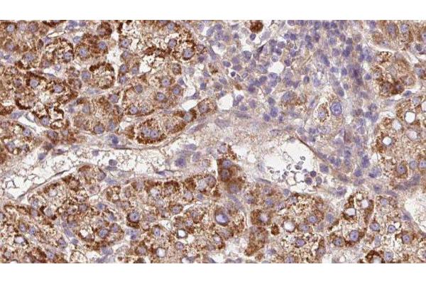 Plexin A2 antibody  (Internal Region)