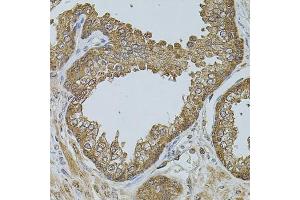 Immunohistochemistry of paraffin-embedded human prostate using CHRFA antibody (ABIN6131933, ABIN6138559, ABIN6138561 and ABIN6223818) at dilution of 1:100 (40x lens). (CHRFAM7A antibody  (AA 1-150))