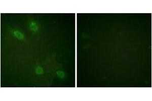 Immunofluorescence (IF) image for anti-Mediator Complex Subunit 1 (MED1) (AA 1423-1472) antibody (ABIN2888695) (MED1 antibody  (AA 1423-1472))