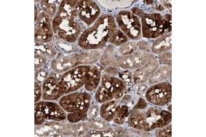 Immunohistochemical staining of human kidney with C20orf196 polyclonal antibody  shows strong cytoplasmic positivity in tubular cells at 1:50-1:200 dilution. (C20ORF196 antibody)