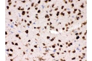 IHC testing of FFPE mouse brain with HuD antibody. (ELAV (Embryonic Lethal, Abnormal Vision, Drosophila)-Like (ELAVL) antibody)
