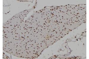 ABIN6276949 at 1/100 staining Human gastric tissue by IHC-P. (HOXA9 antibody  (Internal Region))