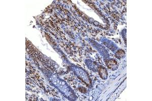 IHC analysis of TRMT61A using anti-TRMT61A antibody (ABIN7599220). (TRMT61A antibody  (AA 1-289))
