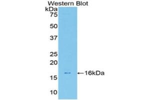 Western Blotting (WB) image for anti-Galectin 7 (LGALS7) (AA 1-128) antibody (ABIN1172746) (LGALS7 antibody  (AA 1-128))