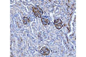 IHC analysis of CD147/Emmprin using anti-CD147/Emmprin antibody (ABIN7599999). (CD147 antibody  (AA 138-323))