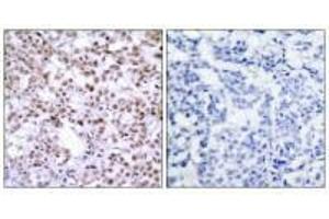 Immunohistochemistry (IHC) image for anti-Checkpoint Kinase 2 (CHEK2) (Thr68) antibody (ABIN7179991)