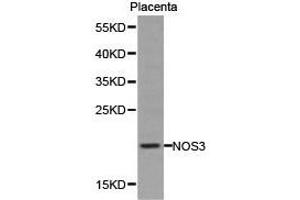 Western Blotting (WB) image for anti-Nitric Oxide Synthase 3 (Endothelial Cell) (NOS3) antibody (ABIN1873922) (ENOS antibody)