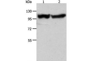 Western Blot analysis of Human fetal muscle tissue and hela cell using ACTN3 Polyclonal Antibody at dilution of 1:400