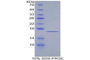SDS-PAGE (SDS) image for Transforming Growth Factor, beta 2 (TGFB2) (AA 303-414) protein (His tag) (ABIN2127052) (TGFB2 Protein (AA 303-414) (His tag))