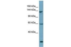 Image no. 1 for anti-LATS, Large Tumor Suppressor, Homolog 1 (Drosophila) (LATS1) (AA 971-1020) antibody (ABIN6741908) (LATS1 antibody  (AA 971-1020))