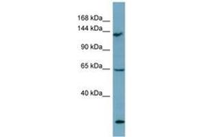 Image no. 1 for anti-LATS, Large Tumor Suppressor, Homolog 1 (Drosophila) (LATS1) (AA 971-1020) antibody (ABIN6741908) (LATS1 antibody  (AA 971-1020))