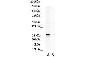 WB Suggested Anti-ASPH Antibody Titration:  0.