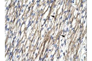 Image no. 1 for anti-RNA Binding Motif Protein 10 (RBM10) (AA 79-128) antibody (ABIN202953) (RBM10 antibody  (AA 79-128))