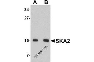 Western Blotting (WB) image for anti-Spindle and Kinetochore-Associated Protein 2 (FAM33A) (N-Term) antibody (ABIN1031572)