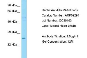 Western Blotting (WB) image for anti-UBX Domain Protein 6 (UBXN6) (Middle Region) antibody (ABIN2788011) (UBXN6 antibody  (Middle Region))
