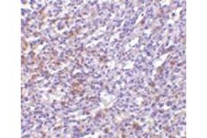 Immunohistochemistry of TCCR in human spleen tissue with this product at 10 μg/ml.