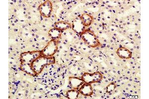 Paraformaldehyde-fixed, paraffin embedded rat kidney tissue, Antigen retrieval by boiling in sodium citrate buffer(pH6) for 15min, Block endogenous peroxidase by 3% hydrogen peroxide for 30 minutes, Blocking buffer (normal goat serum) at 37°C for 20min, Antibody incubation with Rabbit Anti-klotho Polyclonal Antibody, Unconjugated  at 1:400 overnight at 4°C, followed by a conjugated secondary and DAB staining (Klotho antibody  (AA 401-500))