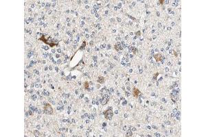 ABIN6266962 at 1/100 staining human brain tissue sections by IHC-P. (ALDOC antibody  (C-Term))