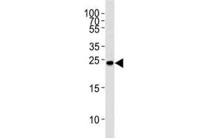 Western blot analysis of lysate from Ramos cell line using GRB2 antibody at 1:1000. (GRB2 antibody  (AA 187-216))