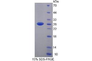 SDS-PAGE analysis of Human YAF2 Protein.