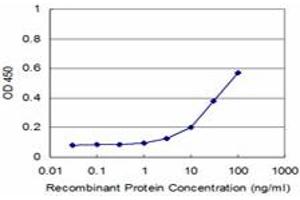 Detection limit for recombinant GST tagged TOPORS is approximately 3ng/ml as a capture antibody. (TOPORS antibody  (AA 98-205))
