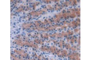 Used in DAB staining on fromalin fixed paraffin- embedded Kidney tissue (Ninein antibody  (AA 1-153))