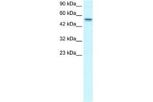 Human HepG2; WB Suggested Anti-RUNX1T1 Antibody Titration: 1. (RUNX1T1 antibody  (Middle Region))