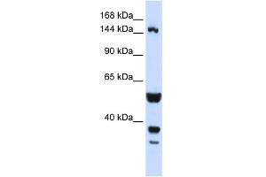 WB Suggested Anti-ABI3BP Antibody Titration:  0.