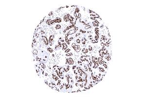 Strong CD34 immunostaining of blood vesels in a mature placenta (Recombinant CD34 antibody)