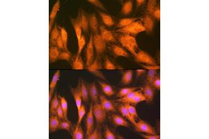 Immunofluorescence analysis of C6 cells using F/UBD Rabbit mAb (ABIN7271134) at dilution of 1:100 (40x lens). (UBD antibody)