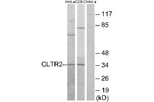 Western blot analysis of extracts from HeLa cells and COLO cells, using CLTR2 antibody. (CasLTR2 antibody  (Internal Region))