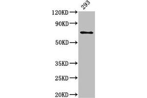 Western Blot Positive WB detected in: 293 whole cell lysate All lanes: LTA4H antibody at 3 μg/mL Secondary Goat polyclonal to rabbit IgG at 1/50000 dilution Predicted band size: 70, 60, 58, 67 kDa Observed band size: 70 kDa (LTA4H antibody  (AA 107-311))