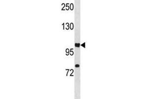 Western Blotting (WB) image for anti-Hypoxia Inducible Factor 1, alpha Subunit (Basic Helix-Loop-Helix Transcription Factor) (HIF1A) (AA 735-762) antibody (ABIN3031278)