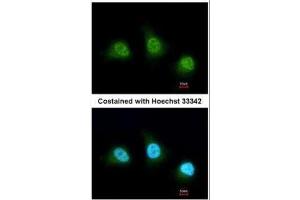 ICC/IF Image Immunofluorescence analysis of paraformaldehyde-fixed HeLa, using PAD4, antibody at 1:200 dilution. (PAD4 antibody  (Center))