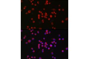 Immunofluorescence analysis of Neuro-2a cells using nNOS Rabbit mAb (ABIN1680436, ABIN1680435, ABIN7101483 and ABIN7101484) at dilution of 1:100 (40x lens). (NOS1 antibody)