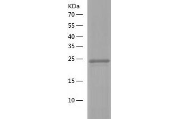 GPR114 Protein (AA 22-250) (His tag)