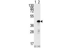 Image no. 1 for anti-SRY (Sex Determining Region Y)-Box 2 (SOX2) antibody (ABIN357439) (SOX2 antibody)