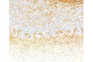 Immunohistochemistry (IHC) image for anti-Neurofilament, Light Polypeptide (NEFL) (AA 150-200) antibody (ABIN7453980)