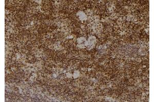 ABIN6277231 at 1/100 staining Mouse spleen tissue by IHC-P. (PSMA2 antibody  (Internal Region))