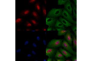 ABIN6260147 and ABIN6266767 staining  cells by IF/ICC.