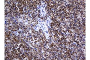 Image no. 2 for anti-NADH Dehydrogenase (Ubiquinone) 1 beta Subcomplex, 10, 22kDa (NDUFB10) antibody (ABIN1499672) (NDUFB10 antibody)