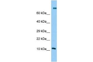 Host: Rabbit Target Name: PLA2G2C Sample Type: Jurkat Whole Cell lysates Antibody Dilution: 1.